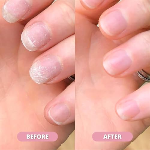 Nailz Nail ๐๐ซ๐จ๐ฐ๐ญ๐ก Pen, Radiant Serum Oil Pen, Cuticle Oil for Nails, Nail ๐๐ฎ๐ญ๐ซ๐ข๐๐ง๐ญ Oil Pens for Moisturize Strengthen ๐๐ซ๐ข๐ ๐ก๐ญ๐๐ง Nails Care (4pcs, 2ml)