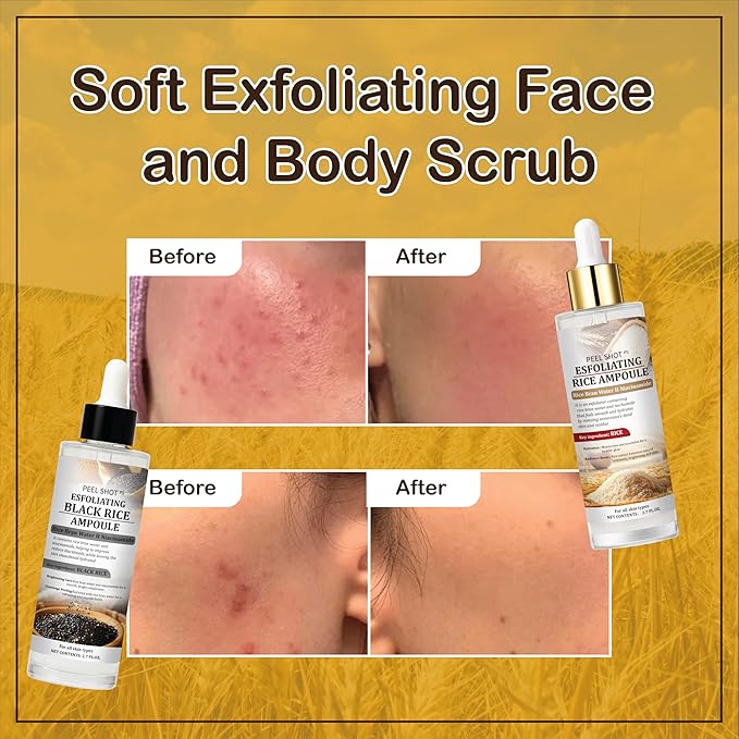 Peel Shot Glow Rice Ampoule Duo, Day & Night Exfoliating Facial Treatment with Niacinamide, Hyaluronic Acid & Rice Extract for Blackhead Removal & Pore Refining (2)