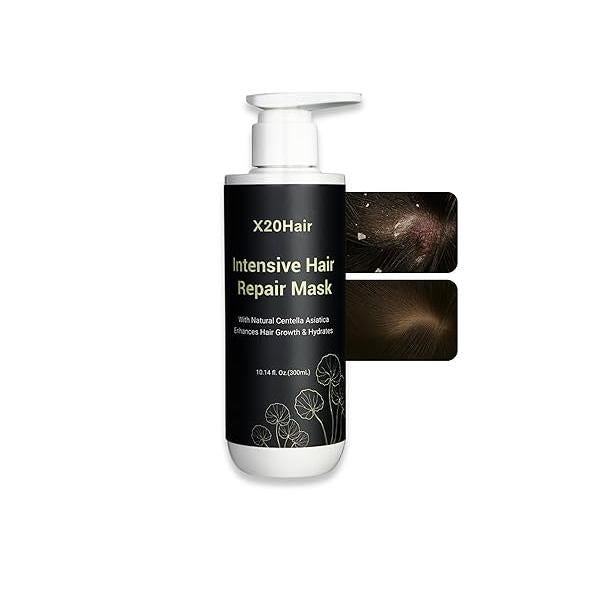 Folliculitis Hair Repair Mask - Effective Scalp Treatment for Seborrheic Dermatitis,Psoriasis, Dry Itchy Scalp, Dandruff | Nourishes Oily - Ideal Women
