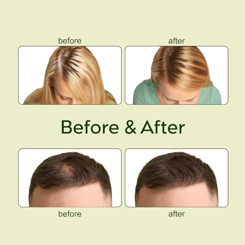 Veganic Natural Hair Growth Oil Kit, Veganic Hair Oil for Hair Growth 2pcs.