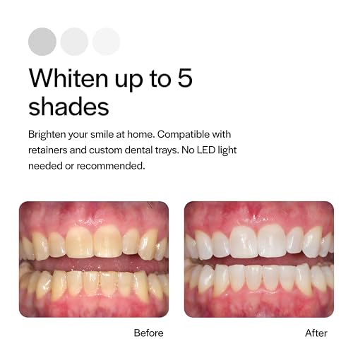 Opalescence 20% Teeth Whitening Refill Kit (2 Packs / 4 Syringes) Carbamide Peroxide. Made by Ultradent, in Mint Flavor. Tooth Whitening Refill Syringes - B-5196-4