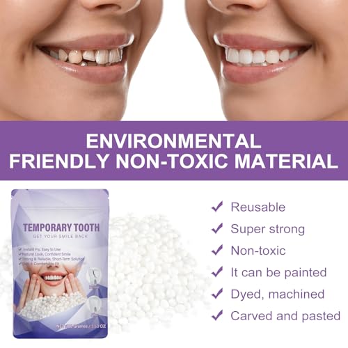 Tooth Repair Kit,Moldable Beads for Teeth Repair,DIY Tooth Filling Repair Kit Fixing The Missing and Broken Replacements, DIY Natural Filling Fake Teeth,Smile Confidently Again(100 Grams)-B01