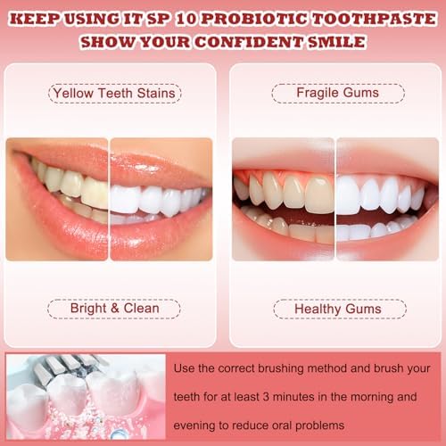 SP-10 Toothpaste Official, Sp-10 Probiotic Toothpaste, Ultra Whitening Sp 10, Deep Cleaning, Super Whitening & Stain Removal, SP 10 Fresh Mint Breath Formula with Probiotic (2 PCS)
