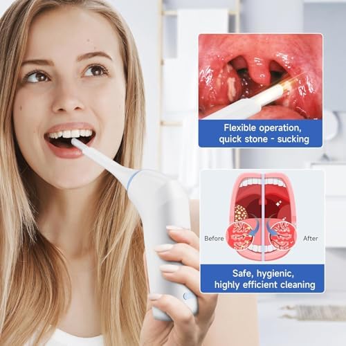 Electronic Tonsil Stone Remover, Vacuum Tonsil Stone Removal Kit with LED Light, 3 Suction Modes, Tonsil Stone Cleaner Tool,Oral Care for Mouth Health, Fight Bad Breath Instant Suction Irrigator