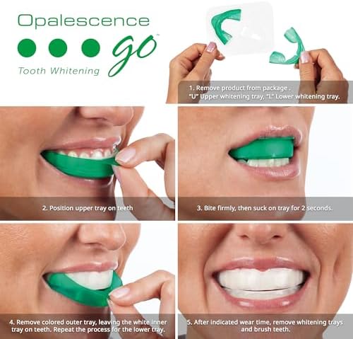 Opalescence Go 10% - Prefilled Teeth Whitening Trays Kit (10 Treatments) - 10% Hydrogen Peroxide - Mint Made by Ultradent Products. Go Teeth Whitening Kit -Mint- GO10-5193-1