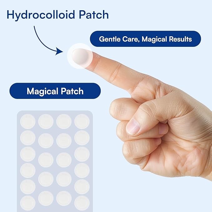 Chel's Magical Cosmetic Acne Pimple Patches | Hydrocolloid Patches for Acne & Zit Treatment | Invisible Spot Cover for Blemishes & Breakouts | Korean Skincare (Pack of 2)