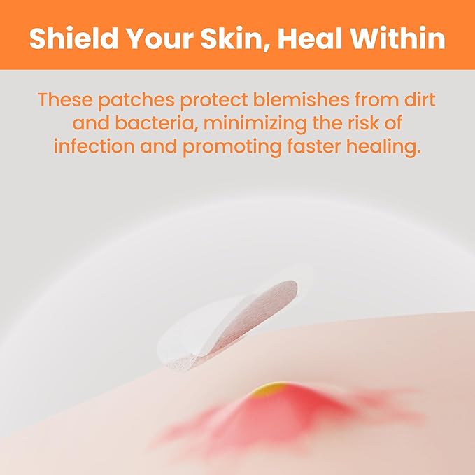 Patchology Not A Spot Hydrocolloid Pimple Patches – 48 Clear Acne Stickers for Face and Body – Skin-Friendly Spot Treatment for Whiteheads, Blemishes, and Breakouts – Invisible and Travel-Friendly