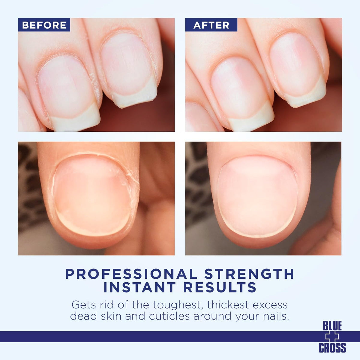 Blue Cross Professional Nail Care Cuticle Remover Liquid with Lanolin (6oz) + Yello Out Purple Toner Nail (0.5oz), 2 Pack Bundle
