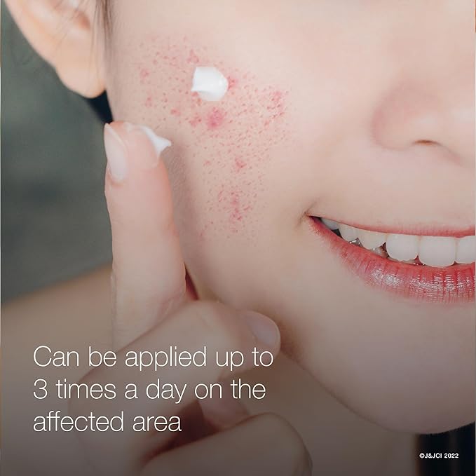 Neutrogena Rapid Clear Stubborn Acne Spot Treatment Gel, Maximum Strength 10% Benzoyl Peroxide Treatment Medication for Acne Prone Skin, Pimple Cream Reduces Size & Redness in 2 Hours, 1 oz