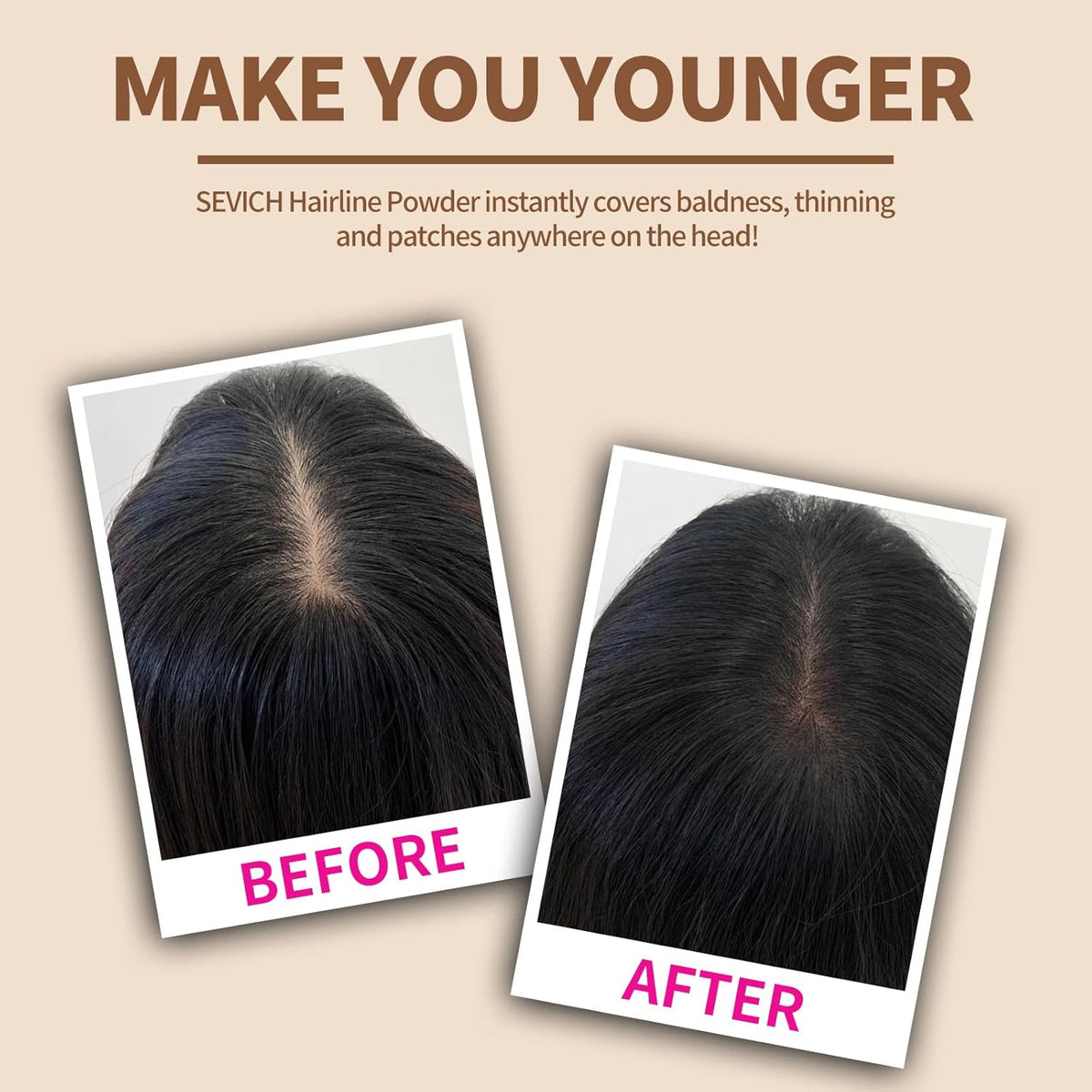 SEVICH Hairline Shadow Powder - Quick Cover for Grey Roots, Eyebrows & Beards, Touch Up Thinning Hair, Windproof & Sweatproof, Light Coffee