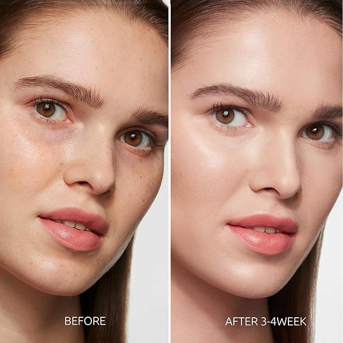 Dark Spot Remover for Face and Body - Dark Spot Corrector Serum for Face - Sun Spots, Age Spots, Freckles & Melasma Remover - Brown Spot Corrector Evens Skin Tone for All Skin Type 1.7 Fl Oz