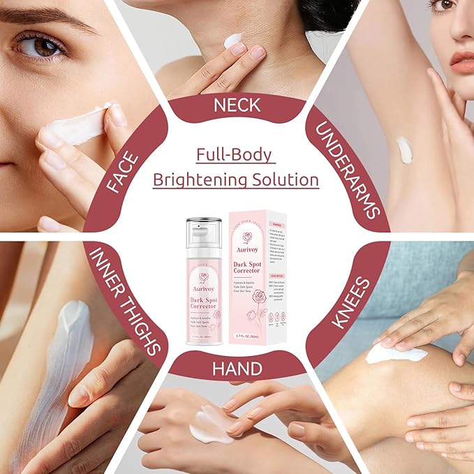 Dark Spot Remover for Face and Body - Dark Spot Corrector Serum for Face - Sun Spots, Age Spots, Freckles & Melasma Remover - Brown Spot Corrector Evens Skin Tone for All Skin Type 1.7 Fl Oz