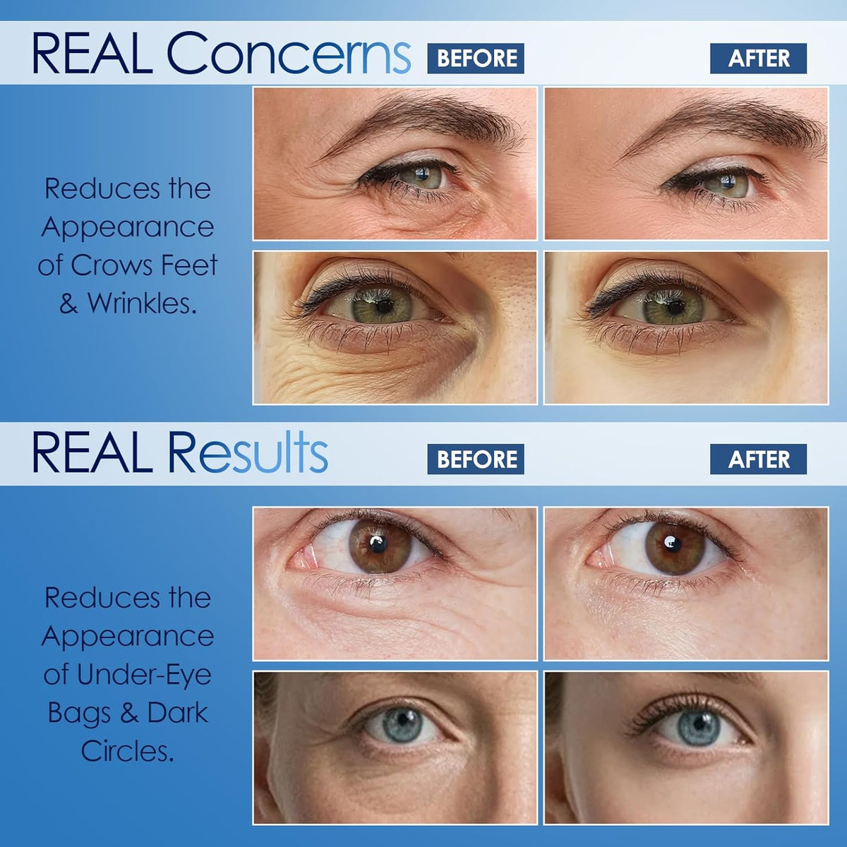 Instant Eye Serum, for Under-Eye Bags, Dark Circles & Wrinkles - Powered by Peptide & Collagen, Smooth and Moisturize (0.17 Fl. OZ (Pack of 1))