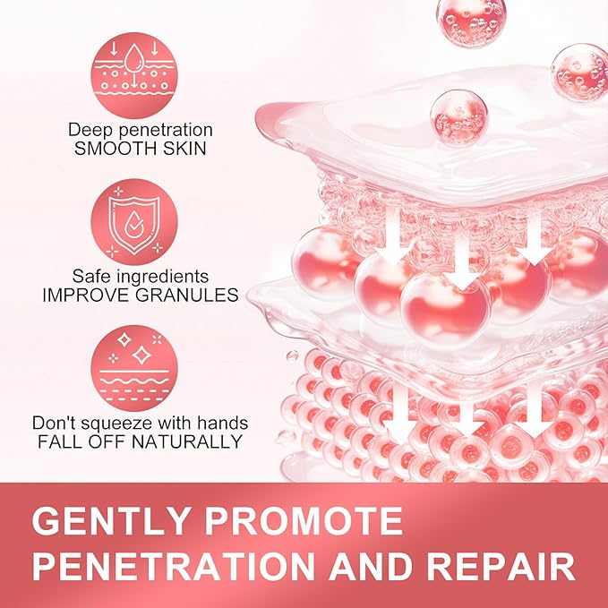 Milia Remover with Salicylic Acid, Milia Spot Remover, Gentle Milia Serum for Face& Eye