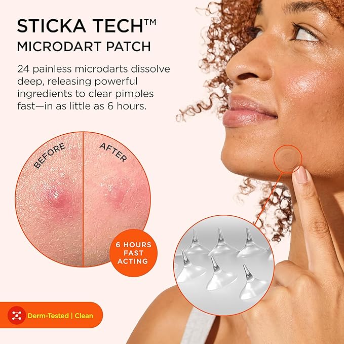ZitSticka Killa Pimple Patches for Face - World's Most Potent Pimple Patch with Fast-Acting Microdarts - Starts Working within 6 Hours for Deep, Early-Stage Zits - Regular 8 Count with Cleana Swab