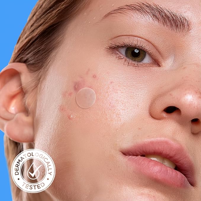 AVARELLE Triple Patch Kits Hydrocolloid Acne Patches, Acne Spot Treatment for Blemishes and Zit with Tea Tree Oil, Calendula Oil and Cica Oil for Face, Vegan, Cruelty Free(40 CT + Support)