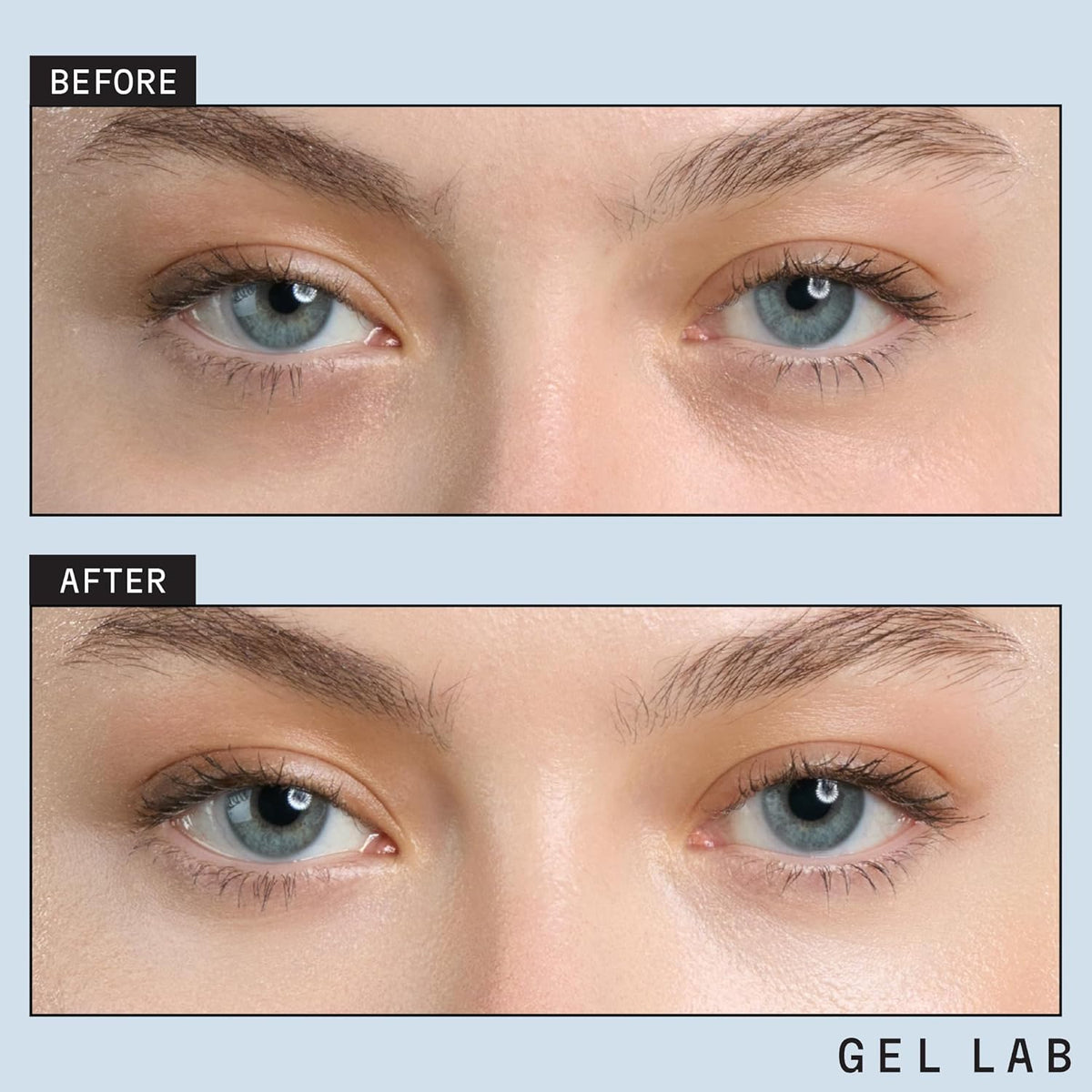 REGLOW Hyaluronic Acid & Caffeine Korean Skincare Eye Patches for Puffy Eyes, Dark Circles, and Wrinkles - Hydrating Under Eye Mask - 60 Gel Patches