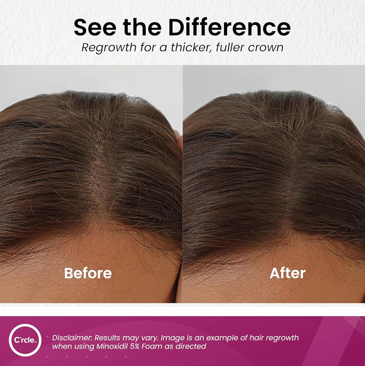 C'rcle Minoxidil for Women 5% Foam - Helps Restore Top of Scalp Hair Loss and Support Hair Growth for Women, Regrowth with Unscented Topical Treatment for Thinning Hair (5% Foam 4-Month Supply)